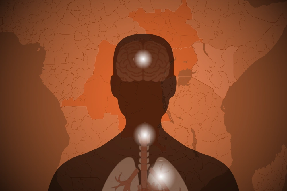 Congo Ebola Outbreak Sparks Global Health Fears Congo Ebola Outbreak Sparks Global Health Fears